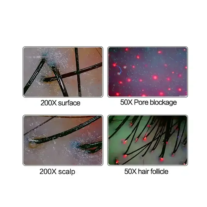 2024 HD Hair Follicles Scalp Detector Scanner Hair Analyzer Scalp Hair Analysis Machine Professional