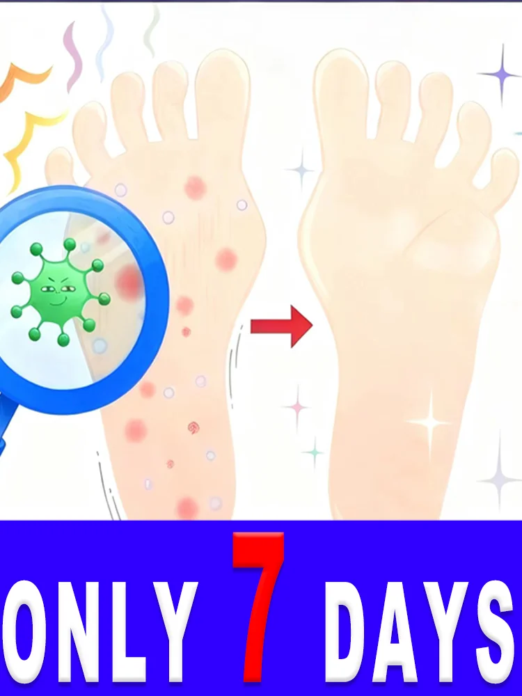 

Sᴀʏ Gᴏᴏᴅʙʏᴇ Tᴏ Aᴛʜʟᴇᴛᴇ's Fᴏᴏᴛ Aɴᴅ Rᴇsᴛᴏʀᴇ ғᴏᴏᴛ Hᴇᴀʟᴛʜ，Return to a comfortable state