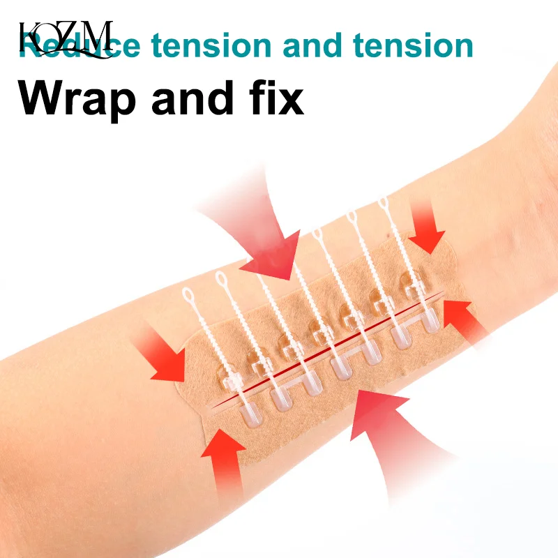 Parche de cierre de herida con lazo con cremallera, parche hemostático para heridas, rápido sin sutura, tirita para exteriores, herida de coágulo rápida portátil