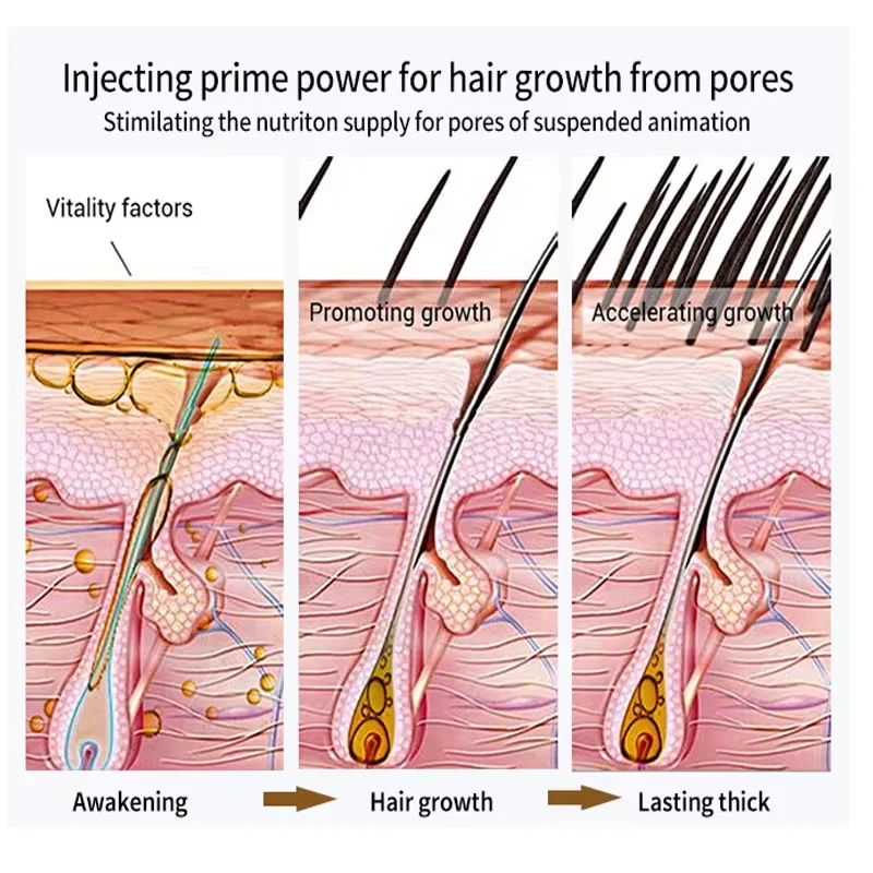 Biotina soro de crescimento capilar, produtos anti-perda de cabelo, crescimento rápido, prevenção de frizz seco, tratamento de reparo danificado, spray de cuidados com a barba do couro cabeludo