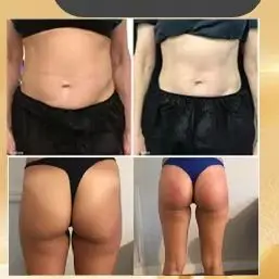 

Ems Neo Electromagnetic stimulate Sculpting Muscle Machine Nova Emszero RF Body Slimming Reduce fat build muscles Machines