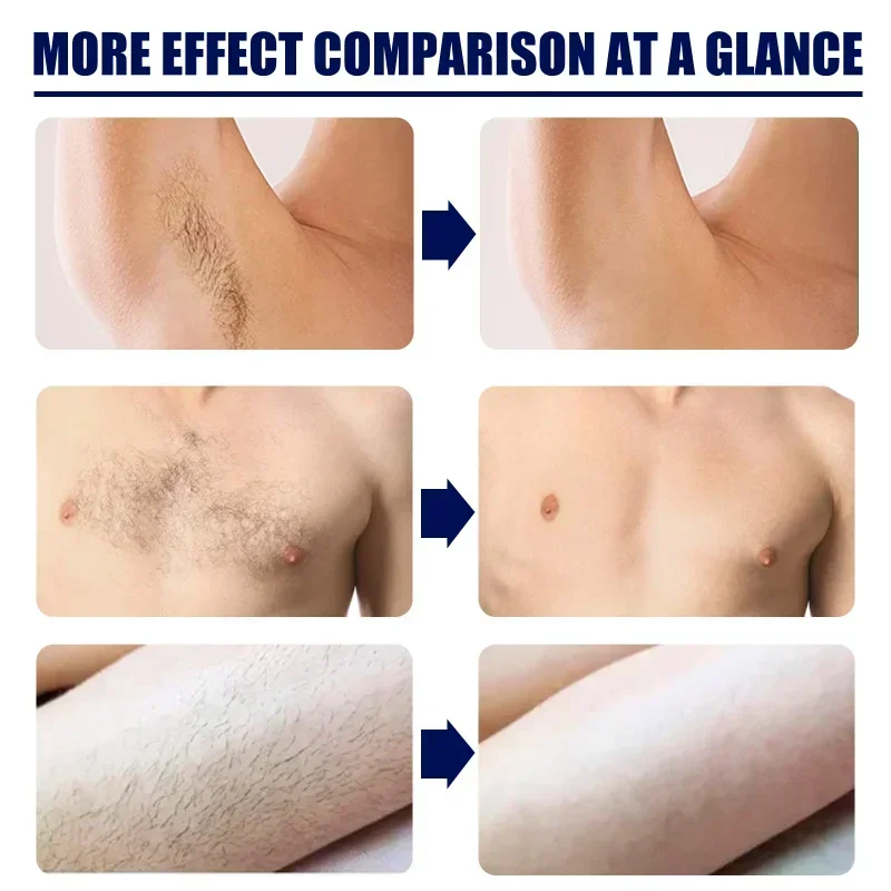 Permanent hair removal cream for men Body Skin care armpit Beard remover Effective Legs Arms chest hair Painless depilation wax