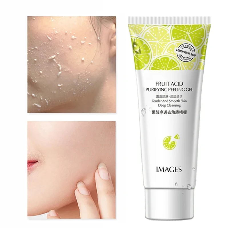 Natuurlijke Fruitzuur Cleanser Gezichtspeeling Exfoliërende Peeling Gel Scrub Gezichtsverwijdering Diepe Peeling Zachte Huidverzorging 80g