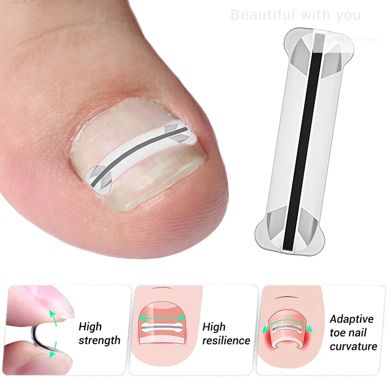 New1Pcs Nail Correctie Stickers Ingegroeide Teennagel Corrector Patches Onzichtbare Hoge Sterkte Extra Patch Paronychia Behandeling