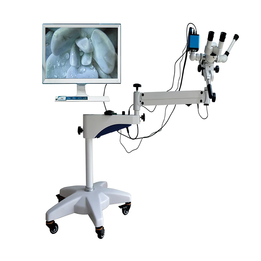 

Medical Colposcope Electronic Colposcope for Gynecology Video Colposcope