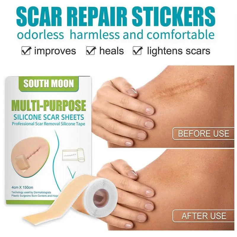 Silicone Scar Sheets Painless Scar Repair Tape Roll For Face Body Acne Skin Care Scar Repair Tools 4cmX150cm