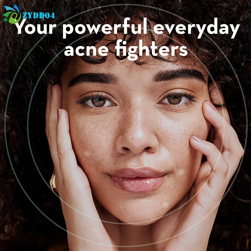 ● 360개 여드름 패치, 여드름 제거 스티커, 피부 관리 스티커, 얼굴 잡티 커버, 뷰티 메이크업 도구