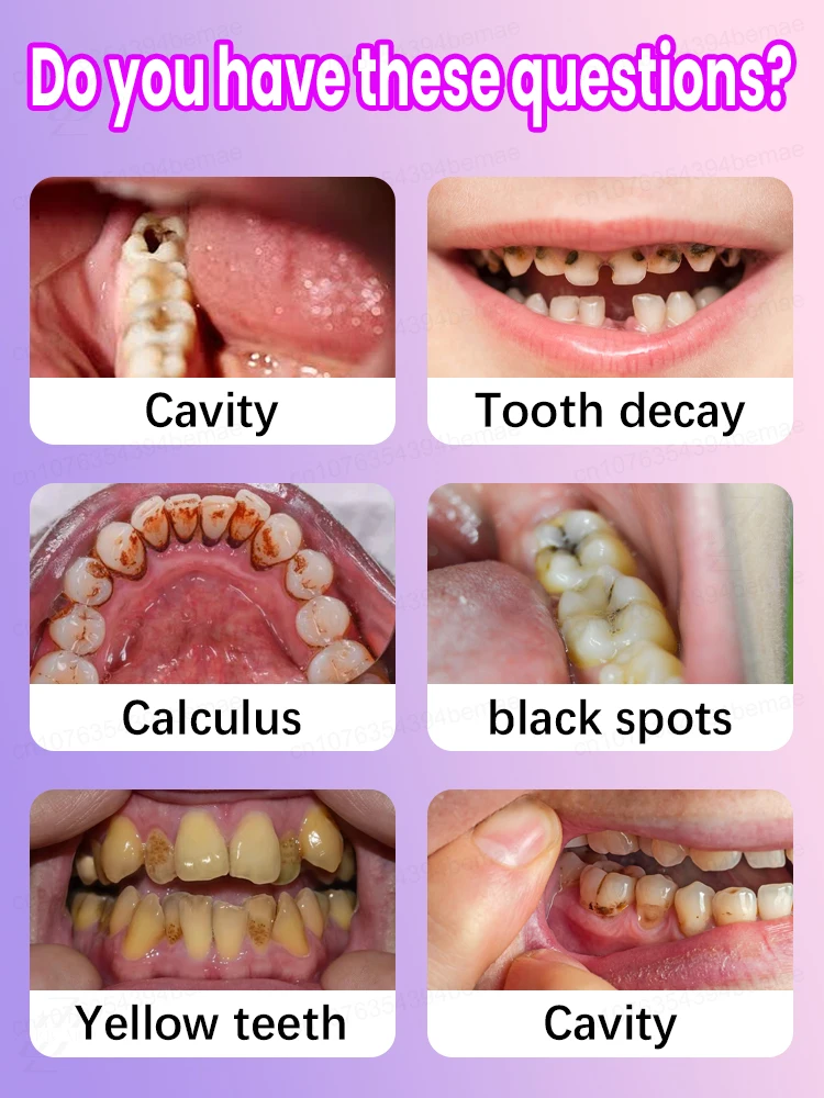 Deeply cleans between teeth, effectively removes plaque, and is a cavity killer.