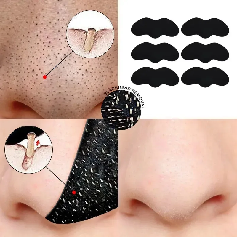 20/40/100pcs Deep Cleansing Pore Nose Black Head Removal Stickers Peel Off Blackhead Remove Mask Nasal Strips Unisex Skin Care