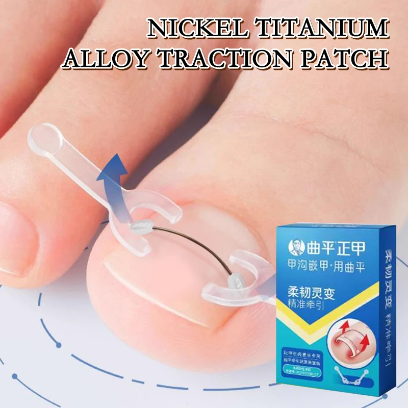 Professional Ingrown Toenail Straightening Clip Brace Ingrown Toenail Corrector Tools Pedicure Recover Embed Toe Nail Treatment