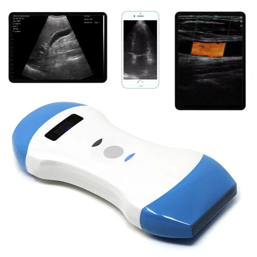 SmartFvet Veterinary Wireless  Veterinary Ultrasound Equipment 3 in1 Veterinary Palm Doppler Ultrasound Wireless Ultrasound