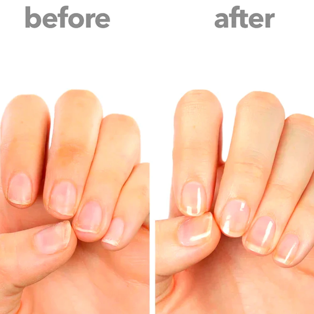 كودي-طلاء أظافر فائق اللمعان ، مقوي أظافر جل ، سائل نمو ، سريع الجفاف ، تشطيب علوي ، مقوي أظافر لعلاج المانيكير #5