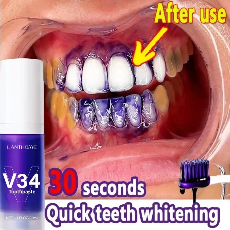 V34 Dentes Branqueamento Mousse Creme Dental, Tooth Care Soro Gel, Remover manchas de placa, Higiene Oral, Hálito Fresco, Ferramentas Dentárias