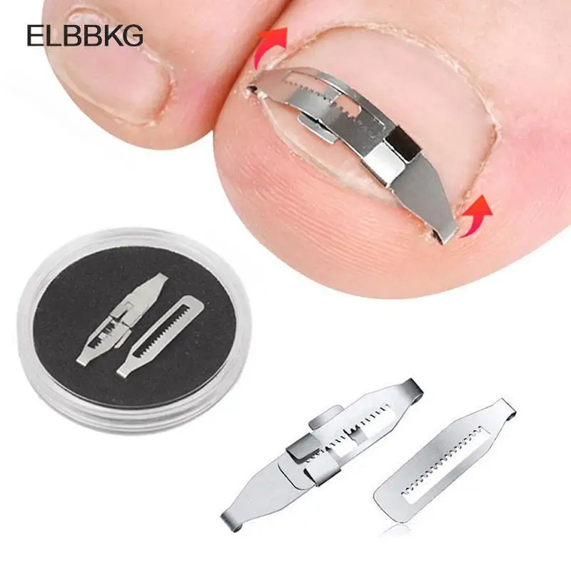 Ingrown Toenail Corrector Tools Pedicure Recover Embed Toe Nail Treatment Professional Ingrown Toenail Correction Foot CareTool