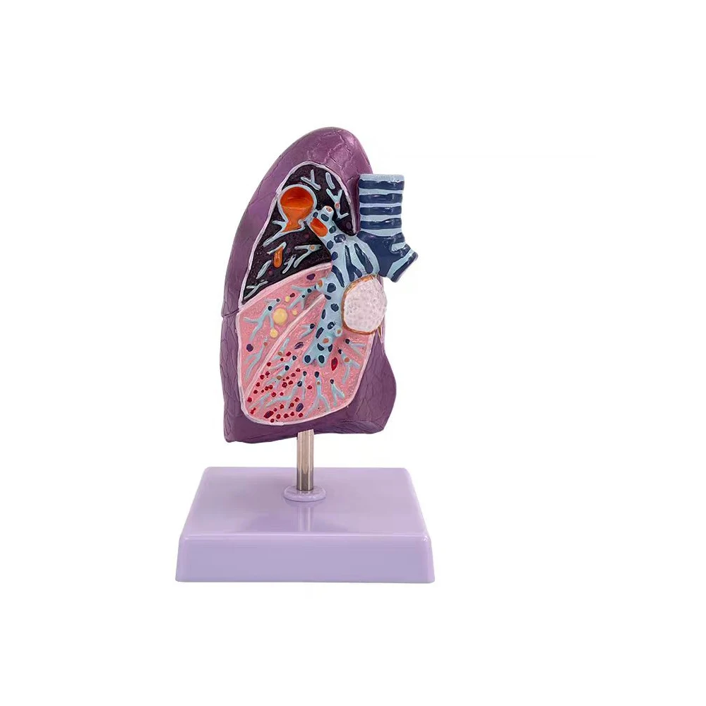 

Anatomical Lung Model Human Teaching Aid Pulmonary Pathological Model