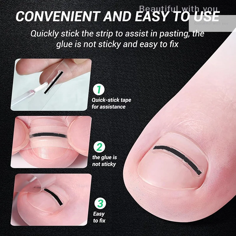 New1Pcs Nail Correctie Stickers Ingegroeide Teennagel Corrector Patches Onzichtbare Hoge Sterkte Extra Patch Paronychia Behandeling