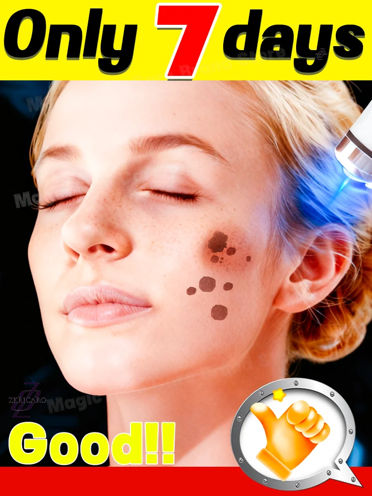 100% 모든 색소 침착을 없애고, 이온 블루라이트 리페어기가 피부 결점을 정확히 찾아 제거합니다. 흠 없는 피부를 만들어 드립니다.