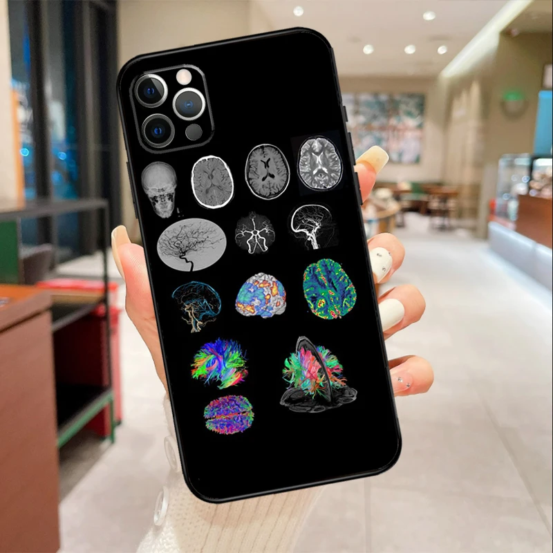 Medical Human Organs Brain Phone Case For iPhone 16 15 13 11 12 14 Pro Max Mini XR X XS Max 6S Plus Cover