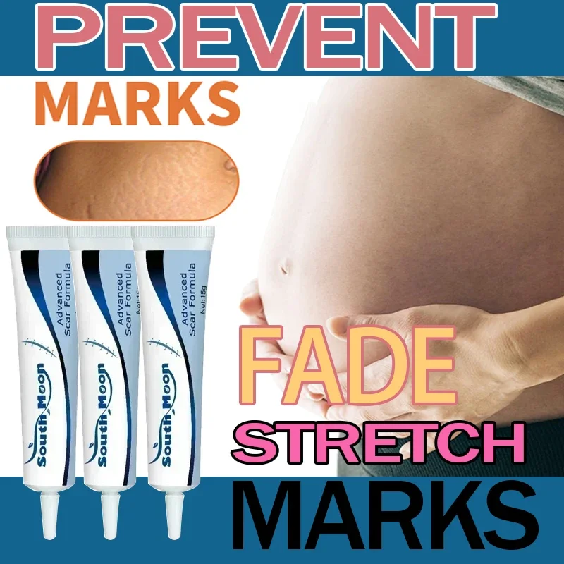 كريم إزالة علامات التمدد كريم إصلاح بعد الولادة للنساء الحوامل علامات نمو السمنة علامات الفخذ لشد البشرة #1