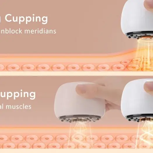 

9-уровневый электрический баночный массажер, вакуумная присоска GuaSha, антицеллюлитный скребок, нагрев, массажная терапия для похудения тела