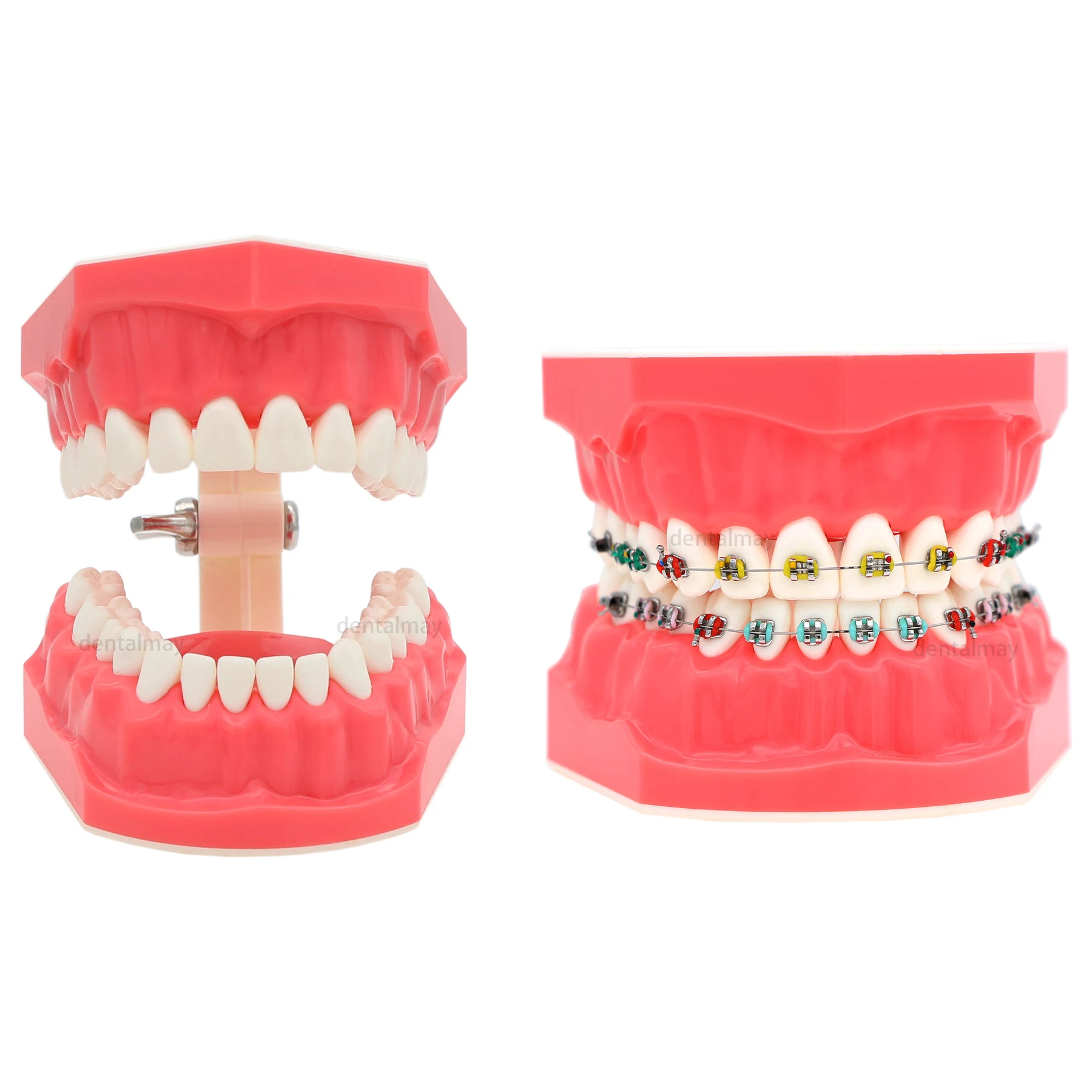 

Dental Typodont Orthodontic Teeth Model with Metal Braces for Brushing Practice M7010-2