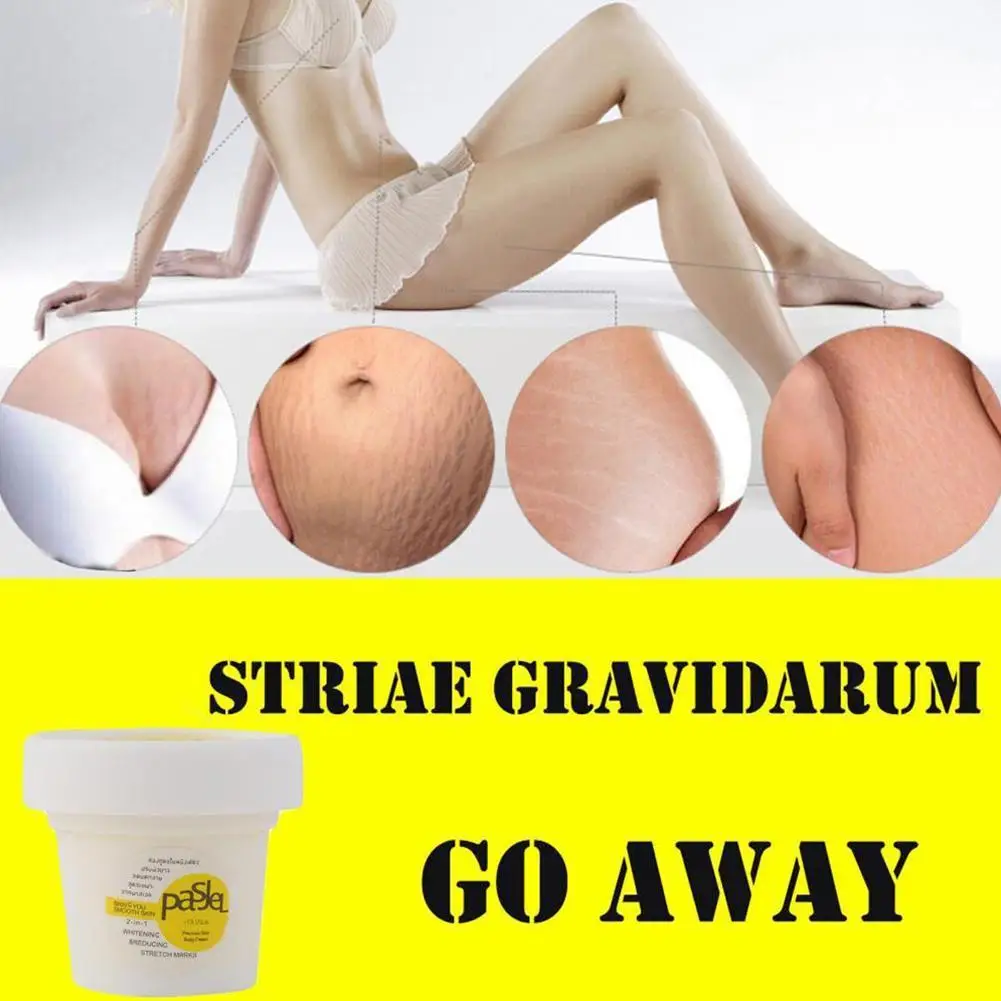 

Thailand Pasjel Stretch Mark Repair Cream Powerful Body Skin Pregnancy Marks Scar Obesity Remover Postpartum Stretch H7D7