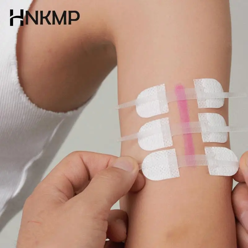 Zipper Band-aid Painless Wound Closure Device Suture-free Wound Dressing Patches Zip Suture Reducer Band Aid