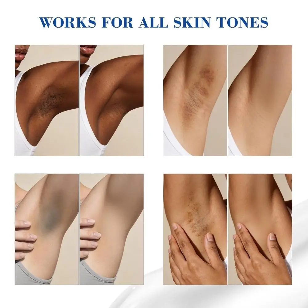 Hydrating Skin Bleaching Cream Whitening Brightening Underam Brightening Cream Skin Lightening Cream