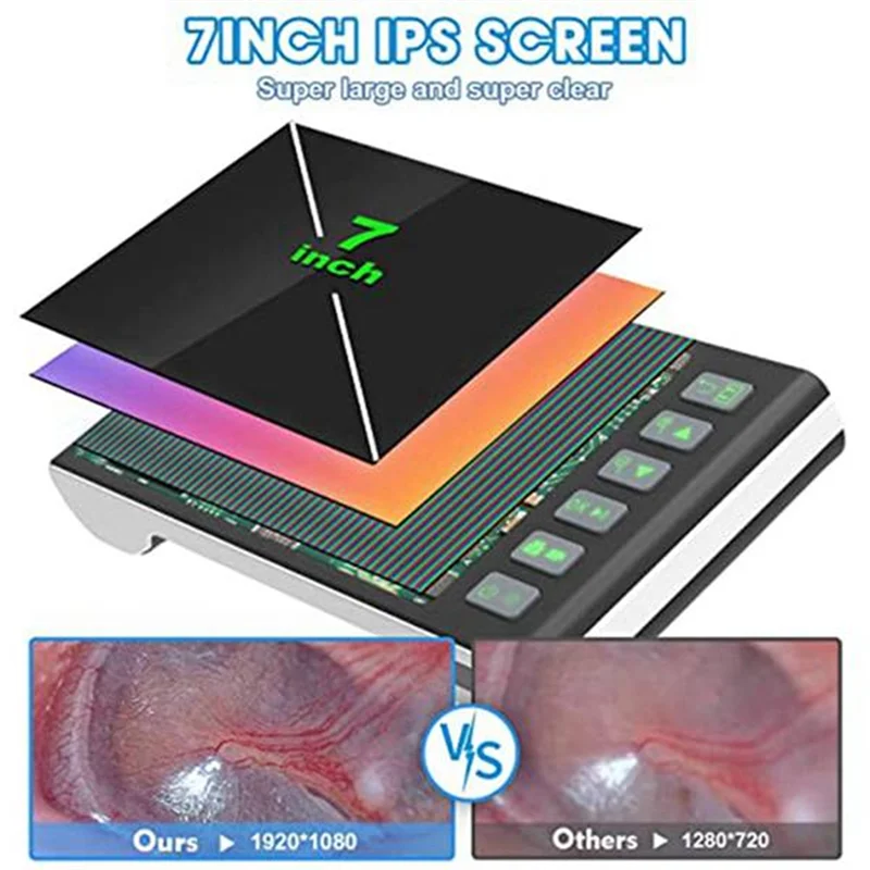 

Classy-Digital Otoscope With 7-Inch Screen, Ear Camera, Visual Ear Scoop Supports Photo Snapshots And Video Recording,Ear Scoop