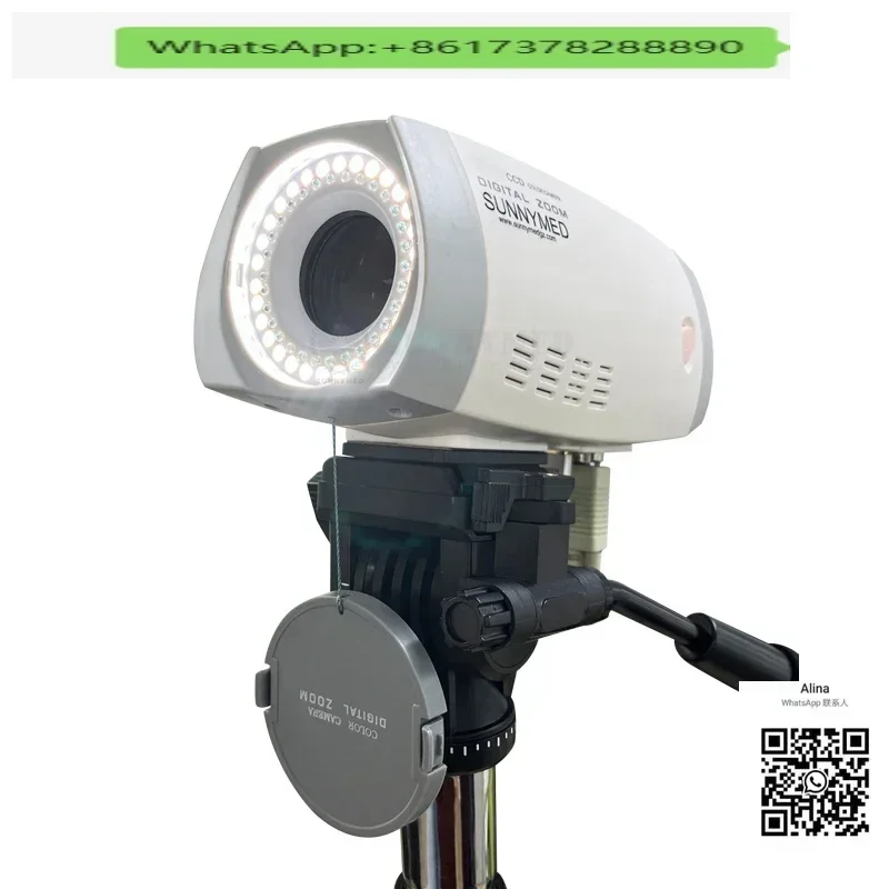 

SY-F005HD-1 HD-видео-колпоскоп-кольпоскопия для гинекологического осмотра-медическая камера