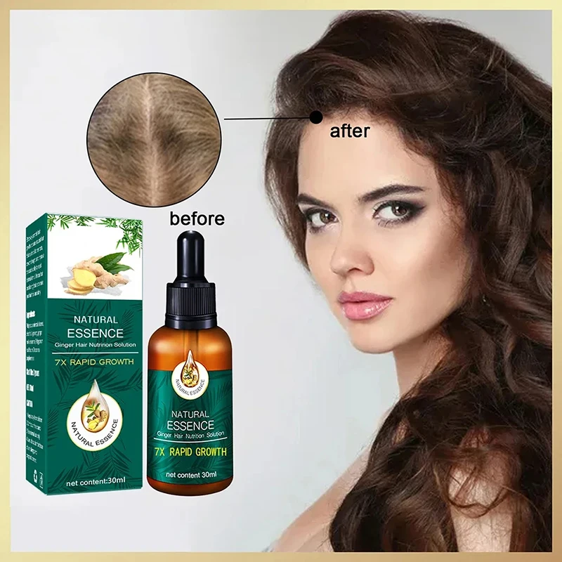 Aceite esencial para el crecimiento rápido del cabello, suero de jengibre Natural para el crecimiento del cabello, previene la caída del cabello, acelere el crecimiento del cabello