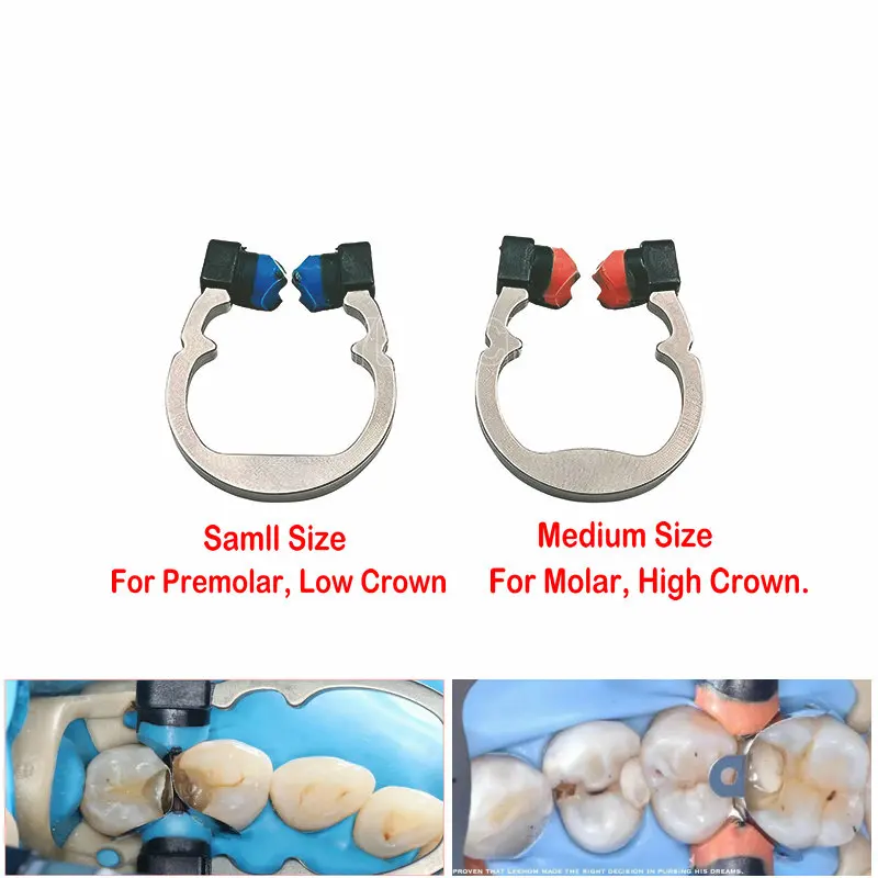 

Dentistry Material Titanium Alloy Matrix Ring Dental NITI Matrix Bands Ring Garrison Style Matrix Clamp Clip Sectional Contoured