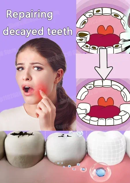 

fashion Reliable Dental paste Prevent Tooth Decay Dental Caries Whitening Teeth Fresh Breath Repair Tooth Decay