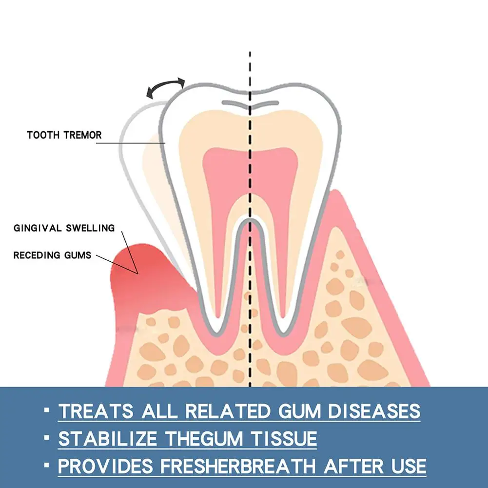 Sérum de réparation rapide des gencives, blanchiment des dents, dentifrice, soins bucco-dentaires