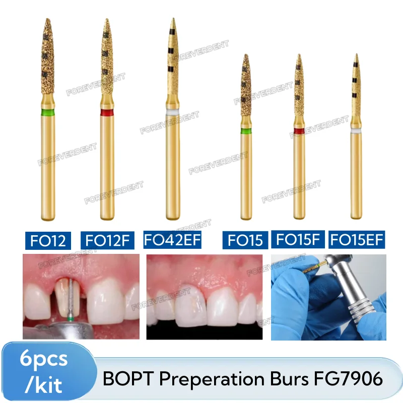 

BOPT FG7906 Dental Preparation Bur Vertical Dental Preparation Restoration Kit Full Crown Restoration Dental Tools