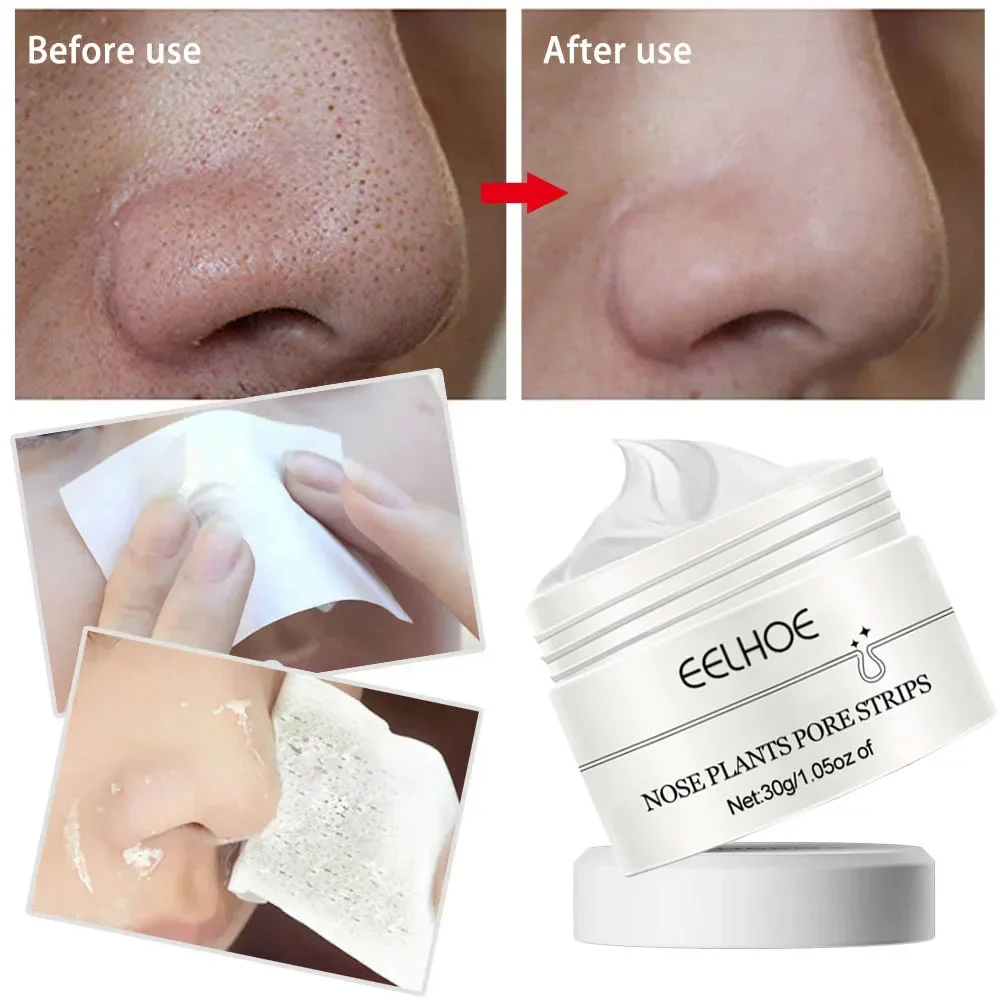 

Hyaluronic Acid Blackhead Remover Nose Mask Firming Shrink Pores Strip Black Mask Peeling Black Deep Cleansing Korean Skincare