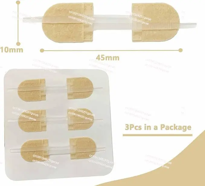 

Устройство для закрытия ран на молнии, полоска для закрытия ран с эластичным бинтом, степлер для закрытой раны в полевых условиях