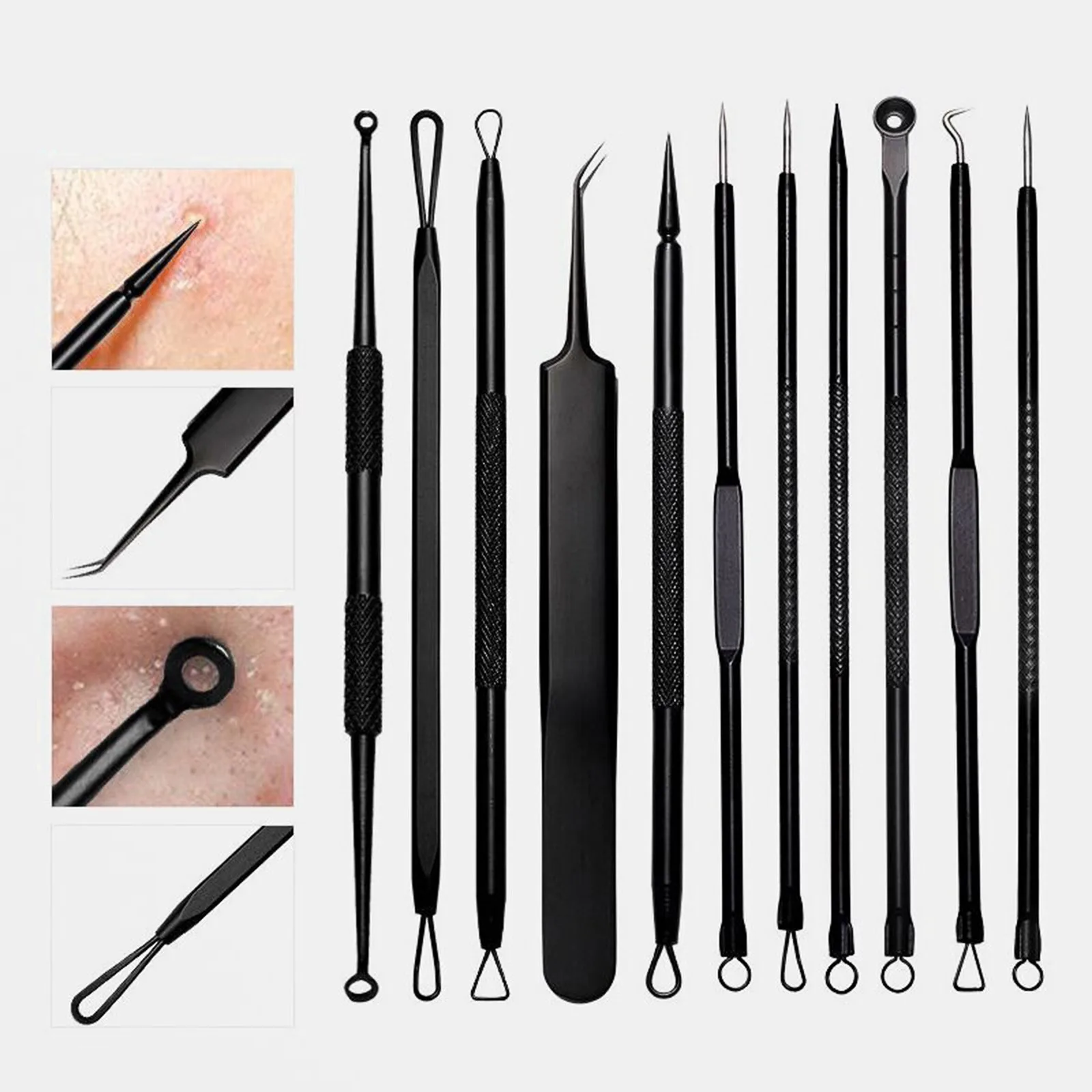 Blackhead Remover Pimple Popper Tool Kit 11 Pcs, Pimple Tool, Acne Kit for Blackhead