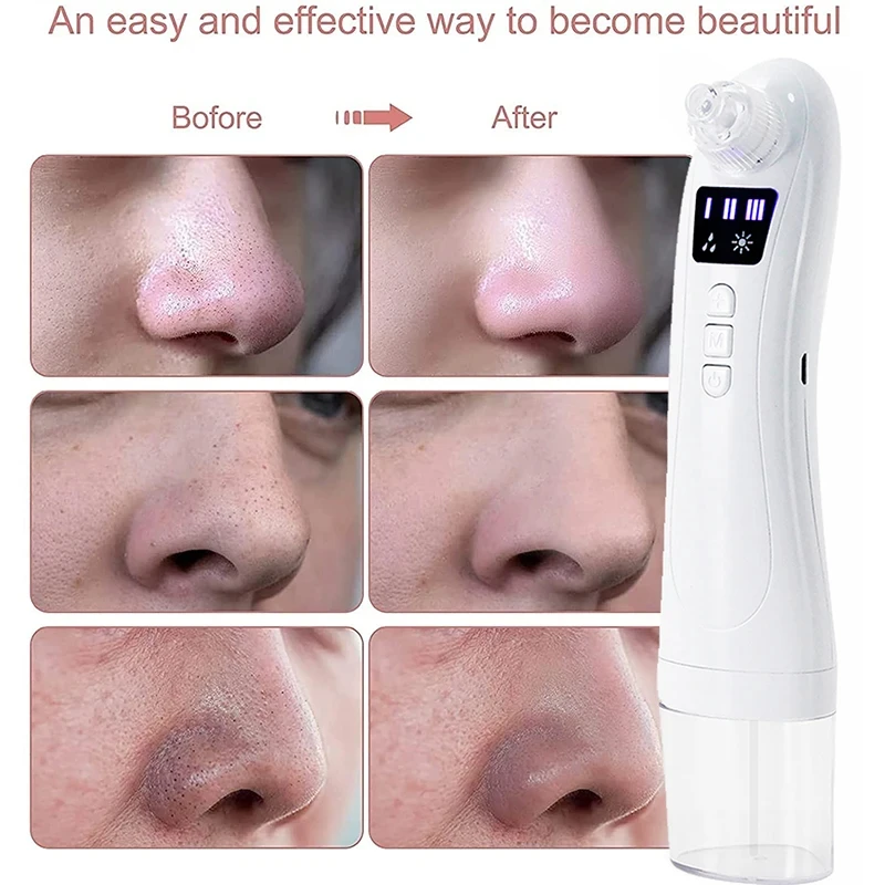 Elektrische Mee-Eter Zuigapparaat Vacuüm Zuigkracht Acne Puistje Black Spot Removal Tool Water Cyclus Gezichts Diepe Reiniger Huidverzorging