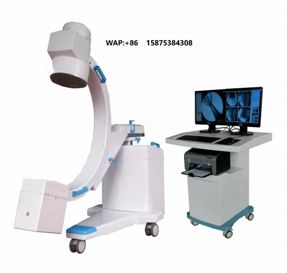 High-quality high-frequency mobile C-arm system, low-cost medical X-ray equipment, medical instruments