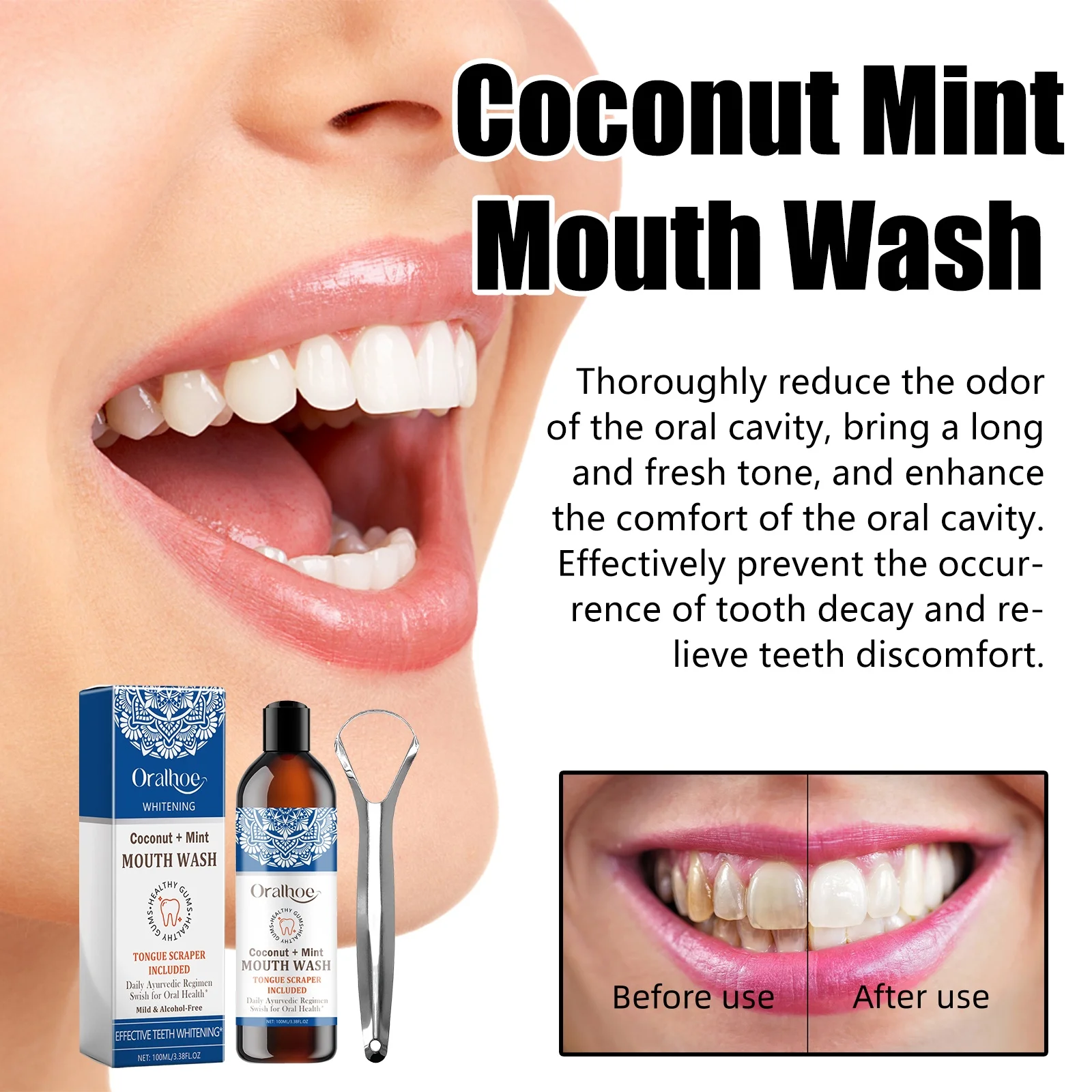 Collutorio alla menta con olio - Teeth Whitening Oil Pulling recensione e prezzo