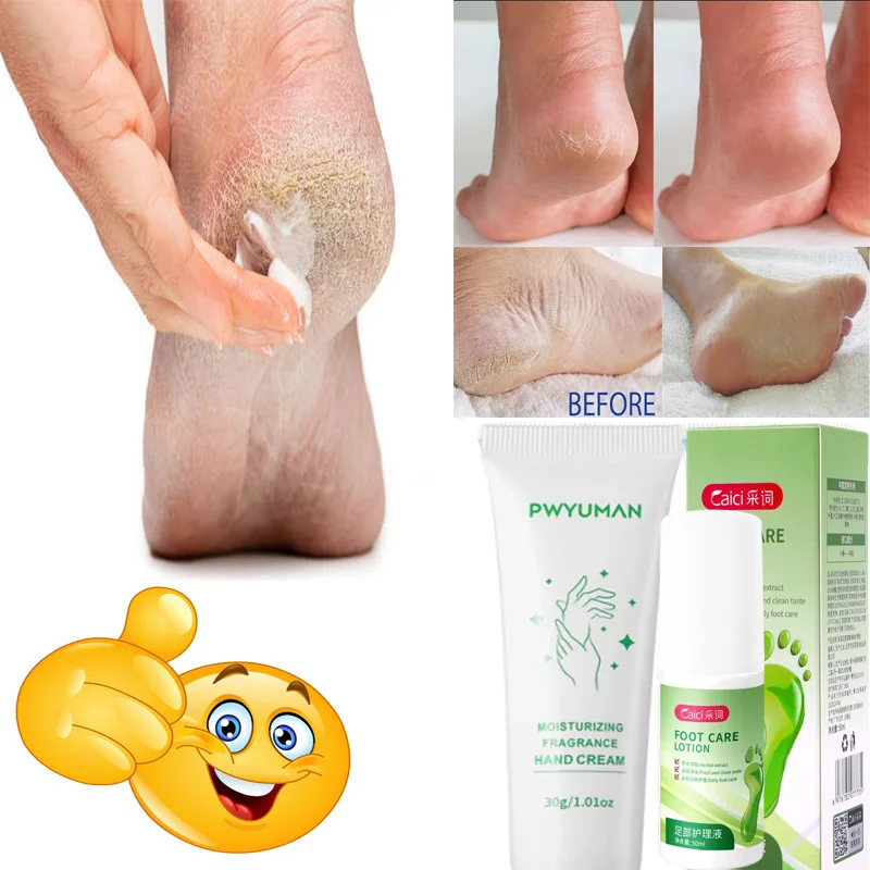 Herbal Anti Crack Foot Cream Spray Heel Cracking Repair Products Exfoliation Dead Skin Removal Softening Moisturize Smooth Care