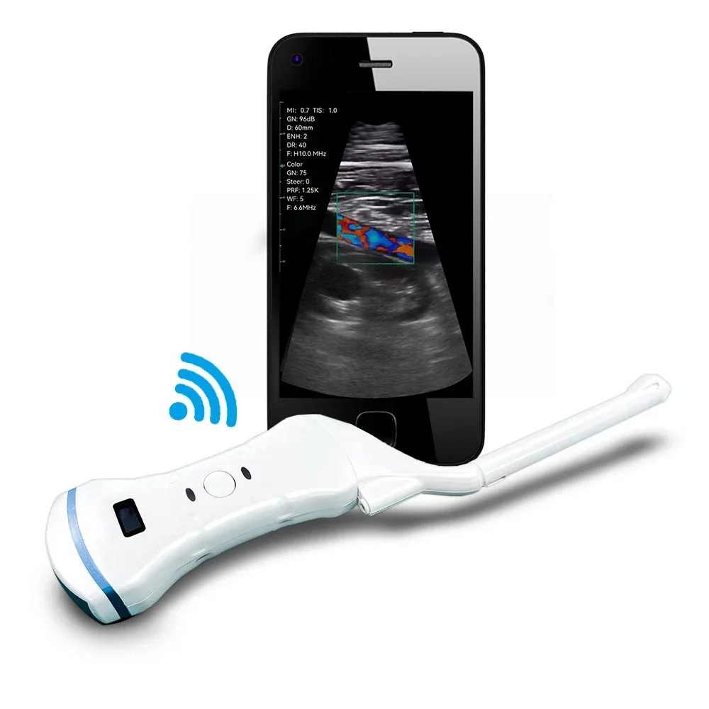 

Мини-ручной сканер 2025/Por, электрическое оборудование для гинеколога, двойной зонд, выпуклый зонд, трансгина