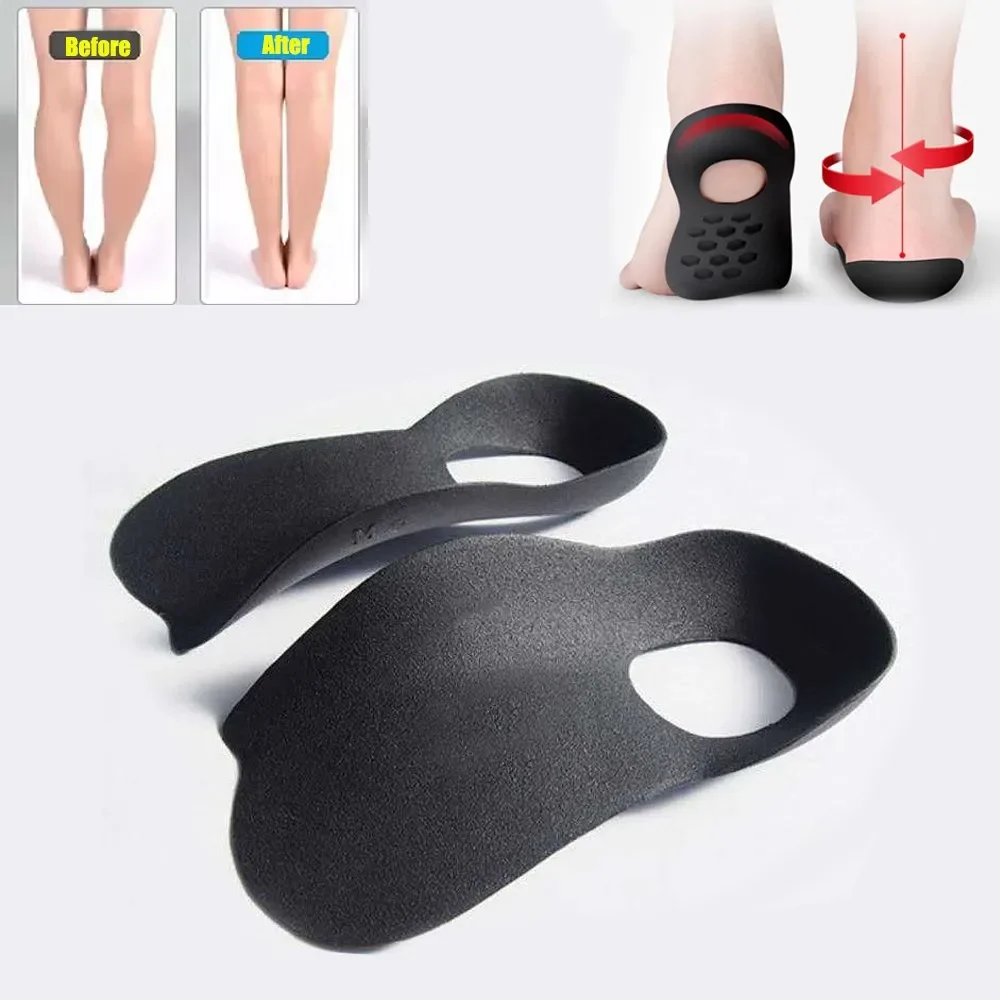 

Orthotic Insoles for XO-Legs Correction Orthopedic Insoles Flat Foot Arch Support Pad Plantar Fasciitis Pain Relief Shoe Inserts