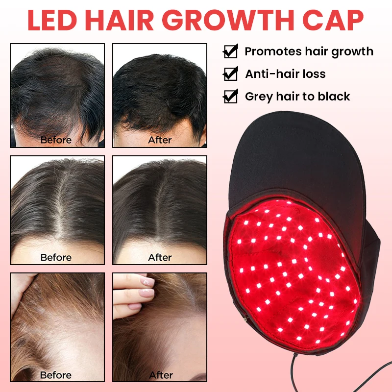 KEMOKO 100 Stuks Infrarood LEDs 660nm & 850nm Rood Licht Therapie Haargroei Cap voor Haargroei Anti Haaruitval ontspannen