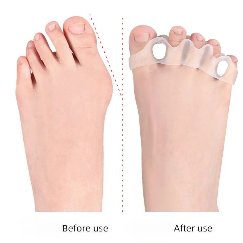 

2 Pairs of Detachable Sponge Plug Foot Separators, Five Hole Toe Dividers, Thumb Eversion, Big Foot Bone Overlap Toe Orthotics