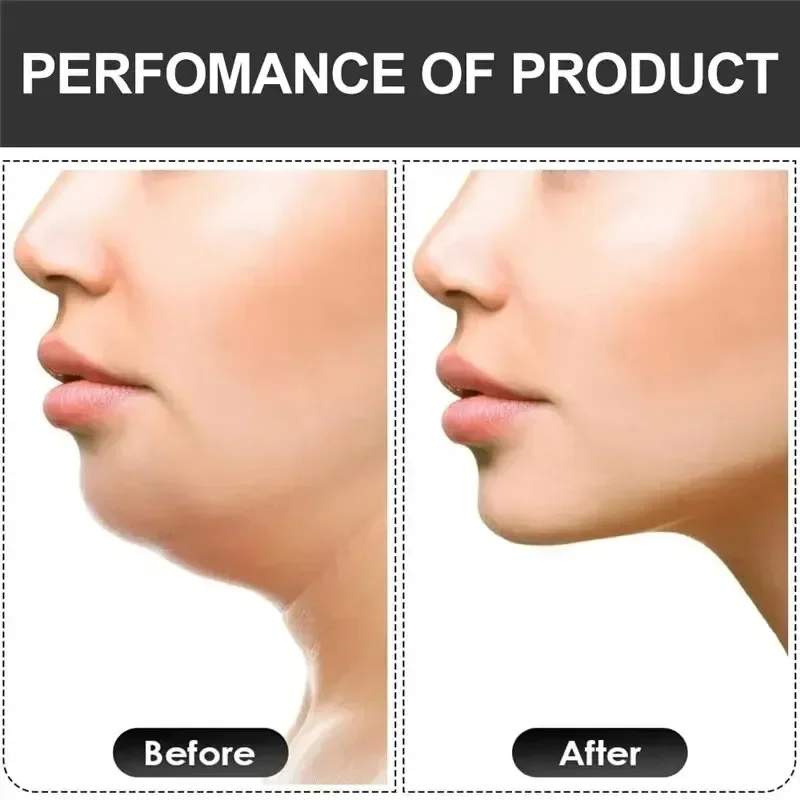 U Shape Jaw Exerciser New Facial Mouth Jawline Face Fitness Muscle Chew Ball Bite Breaker Training Equipment image 6