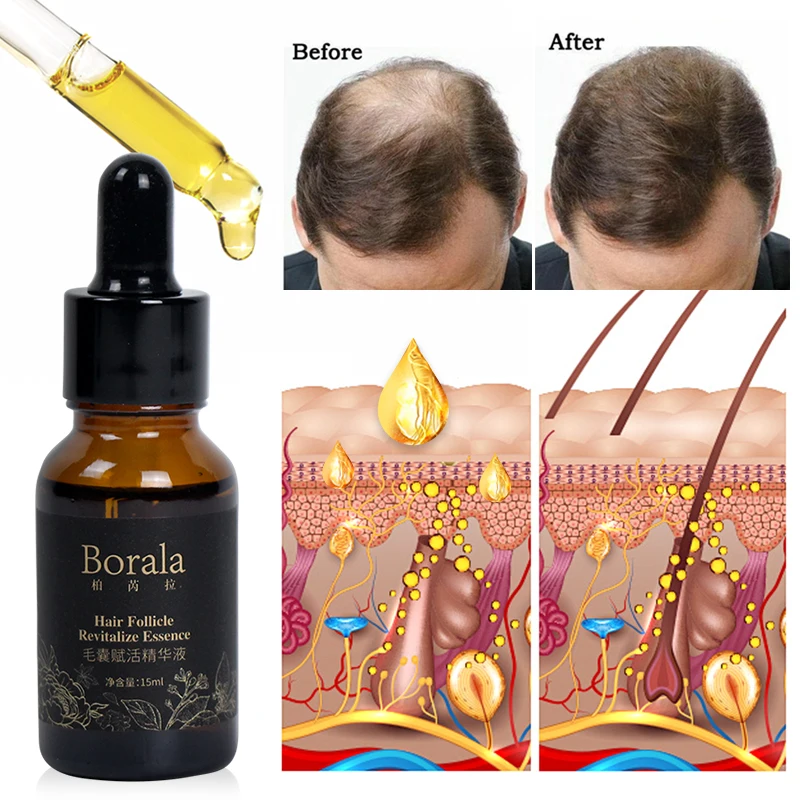 

AIMOOSI BORALA Scalp activating essence