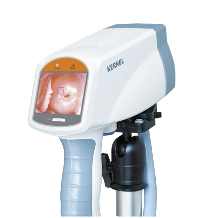 Video Colposcope KN-2200 Harga colposkopik Colposcope untuk ginekologi