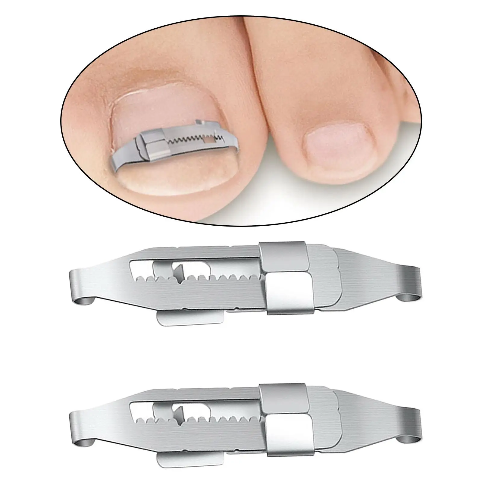 Professional Ingrown Toenail Corrector Tools Embed Toe Nails Treatment